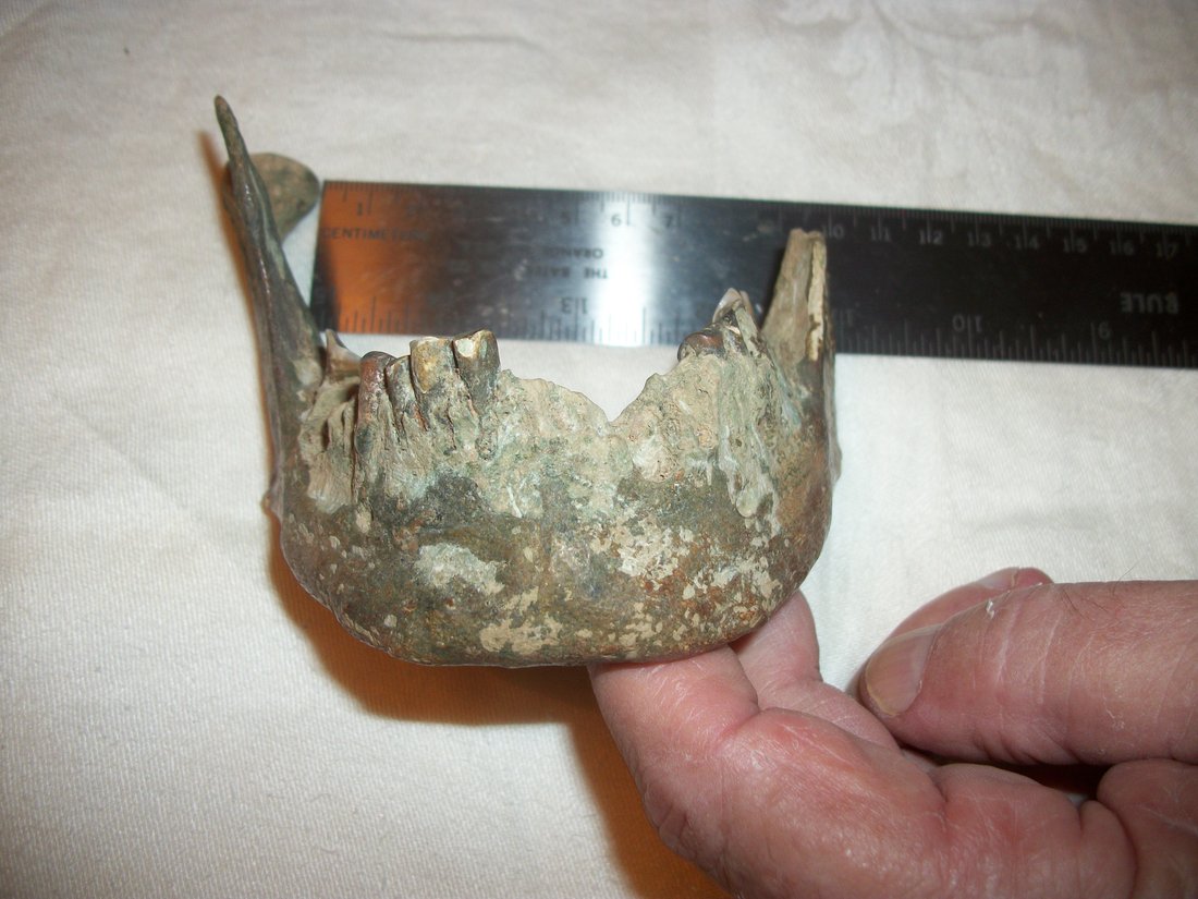 vertical height chin including teeth 3.6 centimeters